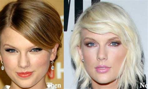 Taylor Swift Plastic Surgery: Nose job, Boob Job, Butt Implant