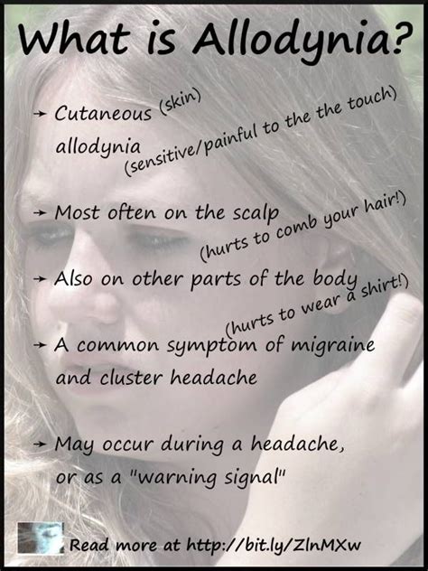 What is Allodynia? | Migraine, Migraine headaches, Complex regional ...