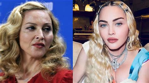 Madonna Before and After Plastic Surgery Journey: What Did She Do to ...