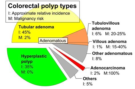 Types Of Colon Polyps Chart