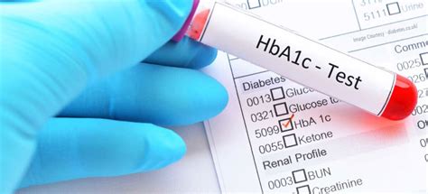 Frequently Asked Questions - HbA1c Test