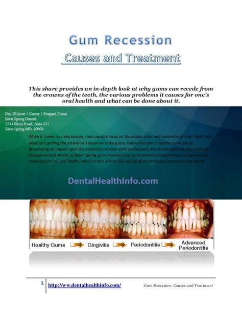 Gum Recession-Causes and Treatment