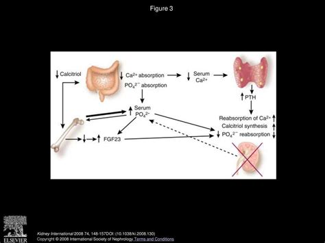 Hyperphosphatemia of chronic kidney disease - ppt download