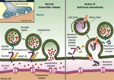 Novel Compound Strongly Inhibits Botulinum Neurotoxin | Sci.News