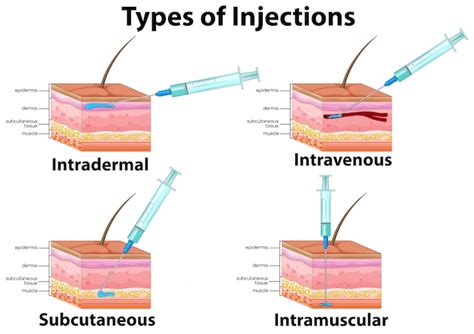 Premium Vector | A set of type of injections