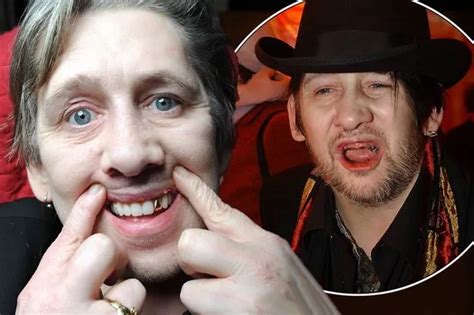 Pogues frontman Shane MacGowan unveils new teeth after undergoing extensive dental work - Mirror ...