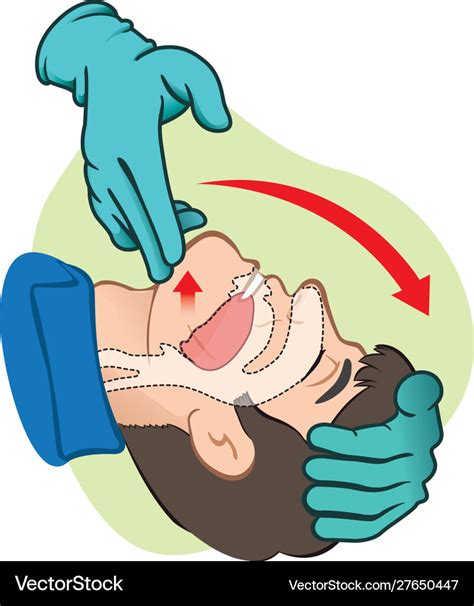 First aid person opening mouth clearing airway Vector Image