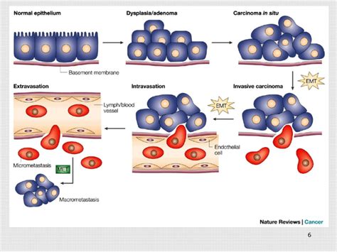 Metastasis