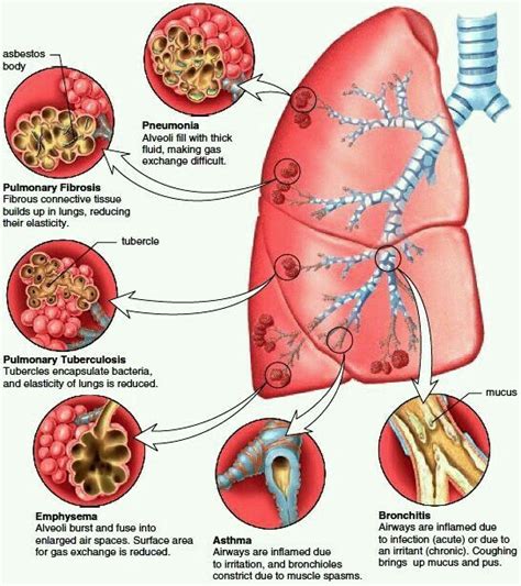 Pin on Anatomy