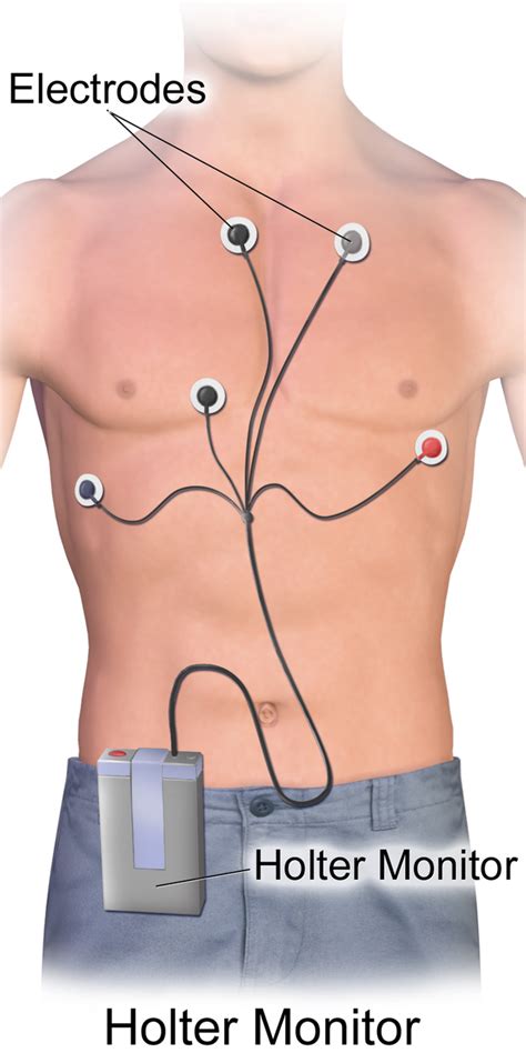 Holter_Monitor - CardiacMonitoring.com