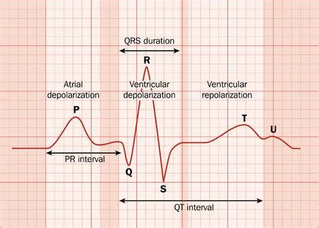 Electrocardiogram (ECG): working principle, normal ECG wave, application of ECG - Online Biology ...