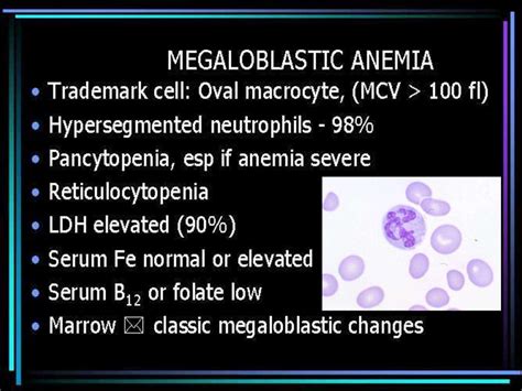 Megaloblastic anemia - online presentation