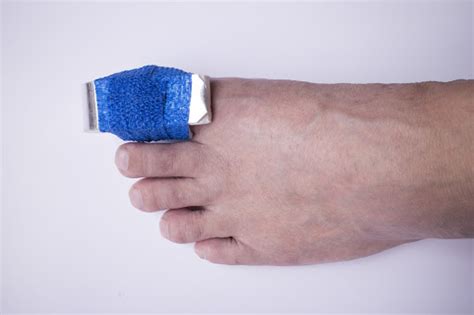 Is My Toe Stubbed or Broken? 3 Tips to Help You Decide - Kansas City Foot Specialists