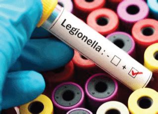 Five Practices to Prevent Legionella Outbreak