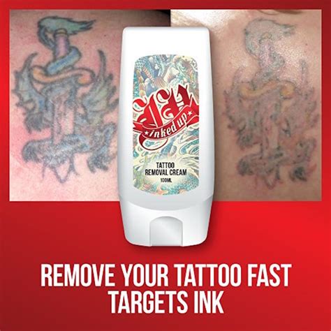 7 Best Tattoo Removal Creams to Erase Unwanted Tattoos & Memories