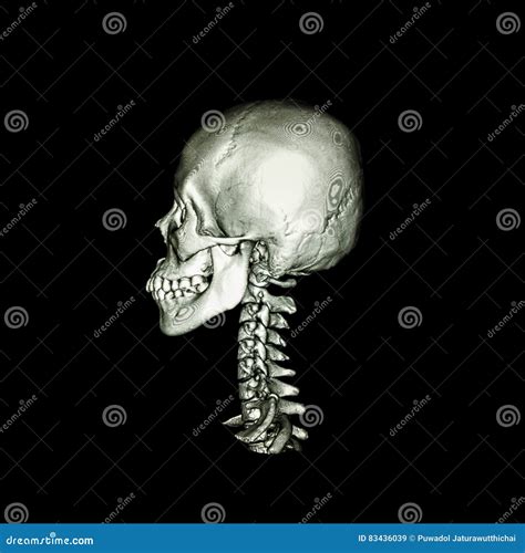 CT Scan with 3D Image of Normal Human Skull and Cervical Spine .lateral ...