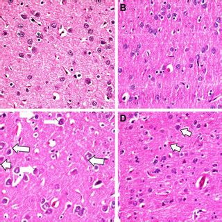 Evaluation of pyknotic alteration between groups in brain tissue.... | Download Scientific Diagram