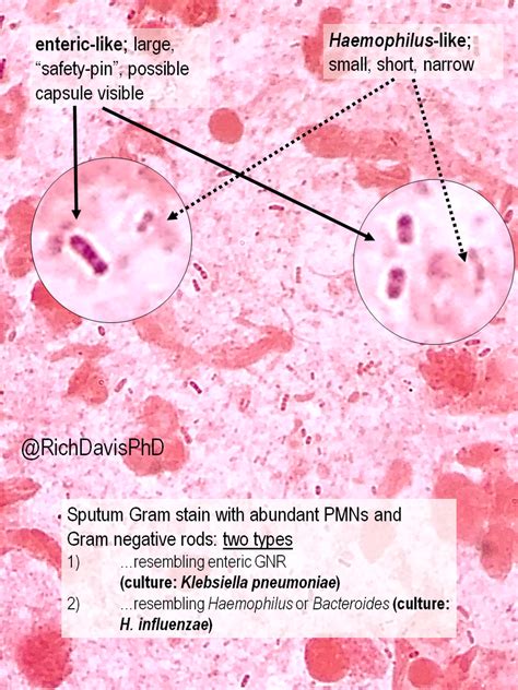 Haemophilus Influenzae Gram Stain - Pin By Nancy De Jesus Torres On Bio ...