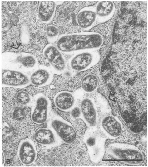 Brucella - microbewiki