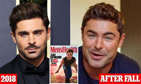 Zac Efron Addresses Plastic Surgery Rumors Amid His Changing Appearance - verloop.io