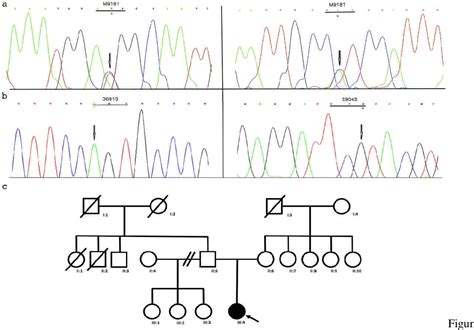 Figure 3 from Multiple Endocrine Neoplasia Type 2B (MEN2B) delayed diagnosis: importance of ...