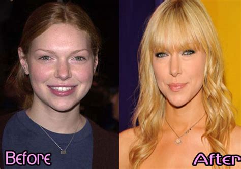 Laura Prepon Plastic Surgery Before After, Breast Implants