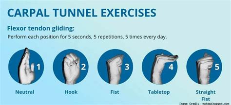 Physical Therapy May Beat Surgery to Treat Carpal Tunnel Syndrome ...