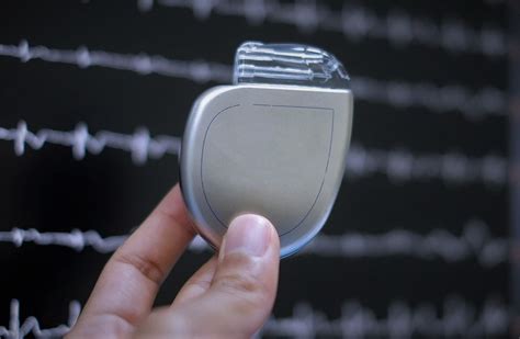 Global Cardiac Rhythm Management Devices Market valued at $10.8 billion ...