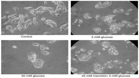 Morphology of HepG2 cells treated with high glucose. HepG2 cells were ...