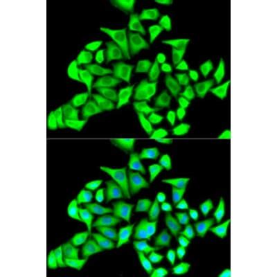 Anti-CD22 Antibody (A11877) | Antibodies.com