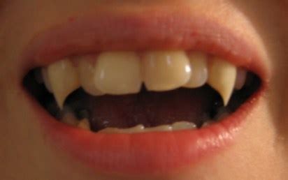 Want Real Fangs? Ask Your Dentist | Vampires