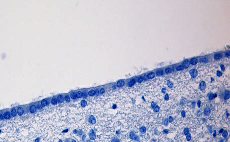 3 Ways Ependymal Cells Nurture the Brain