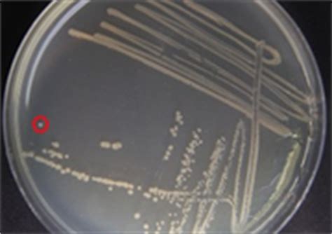 Addgene: Protocol - How to Streak a Plate