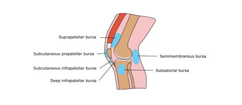 What is Knee Bursitis - - Causes, Symptoms, and Treatment