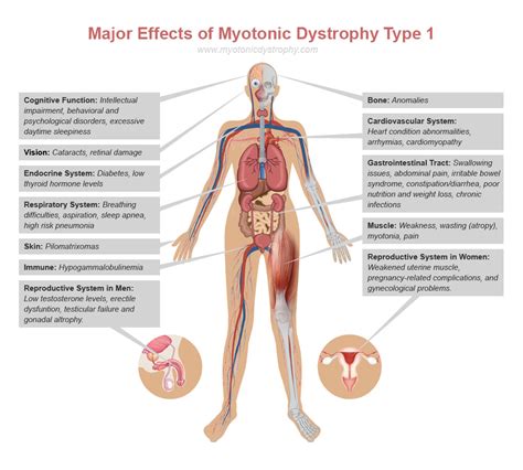 general | Richard Weston's Myotonic Dystrophy Blog