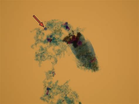 Microscopic Analysis of Urine | Faculty of Medicine, Masaryk University