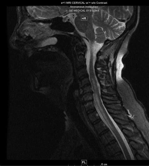 Figure 1 from Neuroimmunology. | Semantic Scholar