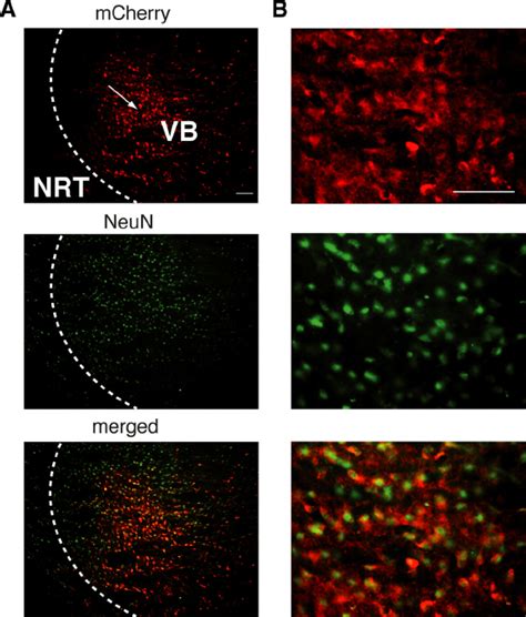 Channelrhodopsin-2 expression in VB TC neurons. A , Immunostaining of ...