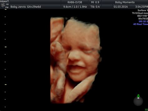 Baby Moments 4D Pregnancy Scan - Blog