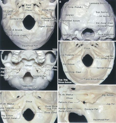 Foramen Magnum | The Neurosurgical Atlas