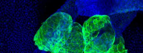 Researchers Discover a New Receptor Regulating Sebaceous Gland Progenitor Cell Function – Cellf ...