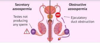 Azoospermia; the ‘sperm-less’ journey to fatherhood - The Spectator