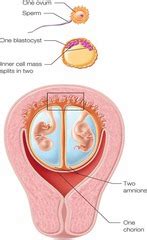 OB 4 - Conception - Twins Flashcards | Quizlet