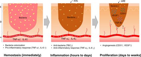 Antimicrobial and anti-inflammatory potential of Angelica dahurica and ...