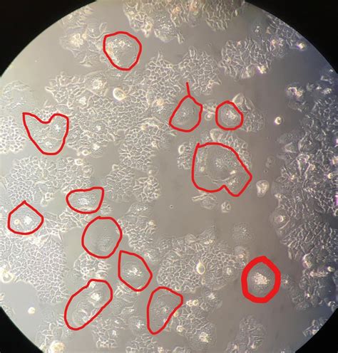 Why my Hela cell culture is having some round shaped weird structures ...