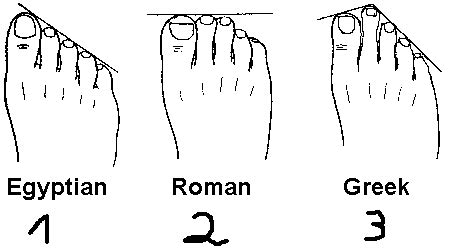 Listed are three Feet types. Which one are you? A little background info: - 1/3 of the ...