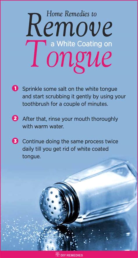 Natural Remedies to Get Rid of a White Coated Tongue