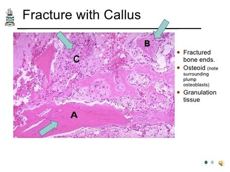 Pathology of Trauma