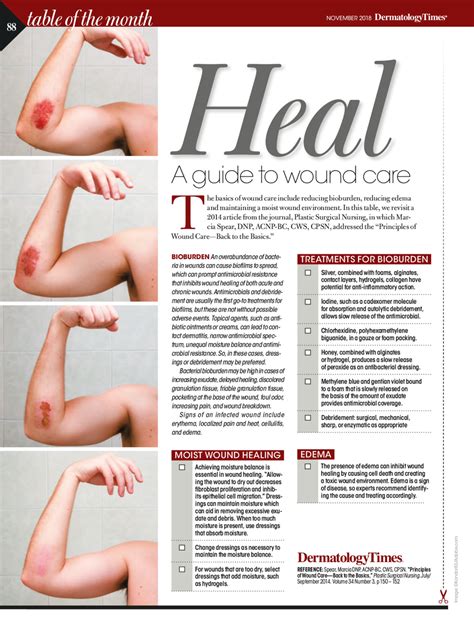 A guide to wound care