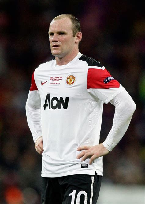 Wayne Rooney Hair Transplant: Soccer Star Reveals Transplant Photos On ...